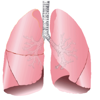 New Radiotherapy Method Effective In Early Stage Lungs Pictures PNG Images