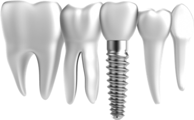 Nail, White, Dental Implant, Tooth Transparent Photos Hd Download PNG Images