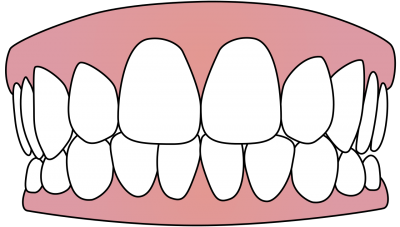 Dentures Drawing, Tooth Background Transparent images Download PNG Images