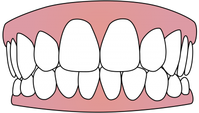 Dentures Drawing, Tooth Background Transparent Images Download PNG Images